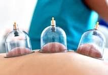 Hijama (Cupping Therapy)